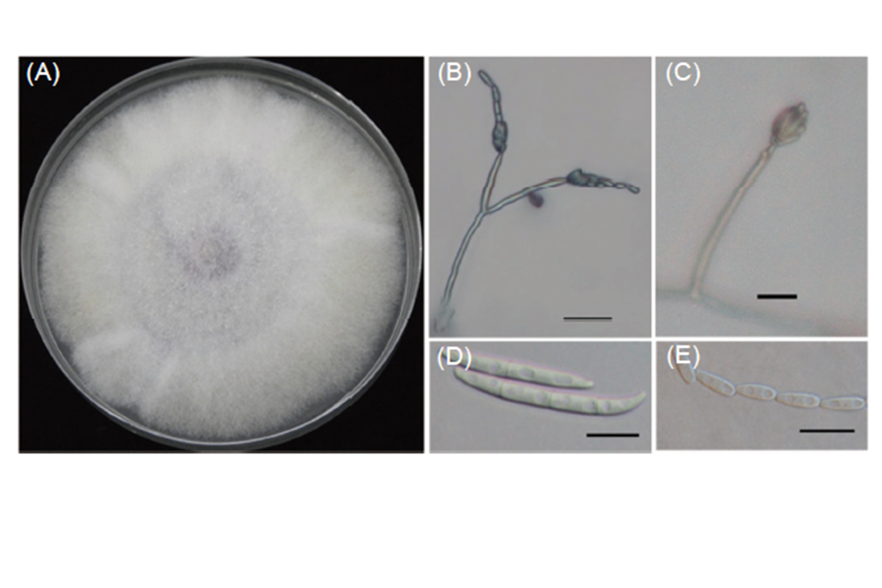 Fig. 2.　Morphology of<i>Fusarium proliferatum</i>. (A) colony pattern of <i>F. proliferatum</i> cultured on potato dextroseagar (PDA) at 25℃ for 7 d